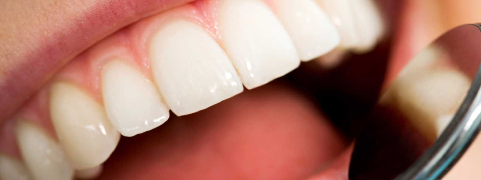 Cosmetic dentistry options improve appearance and enhance your smile